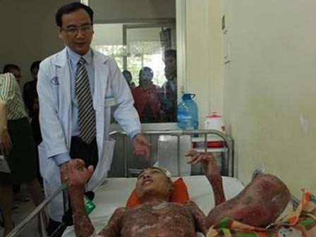 Hút thuốc trong lúc sửa xe, một thanh niên cháy toàn thân