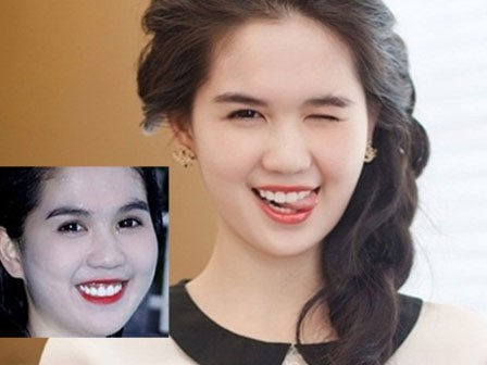 Ngọc Trinh khiến ai cũng sốc với hàm răng “thời nguyên thủy”