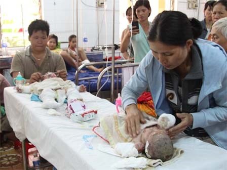 Hai bé bỏng xăng trong vụ cả nhà bị đốt đang nguy kịch