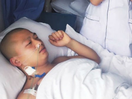 Bị đau, phát hiện trong bụng có 4 quả thận