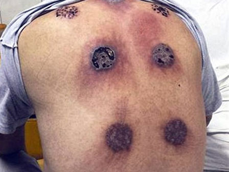 Bé gái 3 tháng tuổi đang ngủ thì bị tổn thương đầu và hoại tử bàn tay trái bởi nghi phạm ít ai nghĩ đến-2