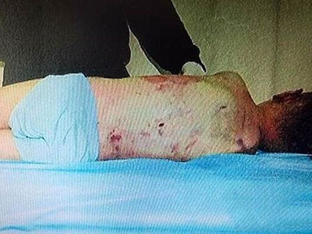 Rúng động vụ án cậu bé 5 tuổi bị người yêu của mẹ hành hạ đến chết