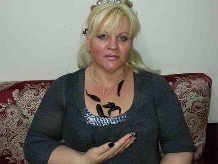 Người phụ nữ giảm được gần 60kg cân vì cho đỉa hút máu thoải mái