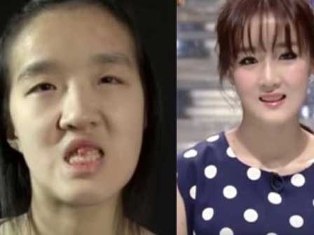 Kinh ngạc nhan sắc 'ma chê quỷ hờn' của bà mẹ trẻ sau phẫu thuật thẩm mỹ