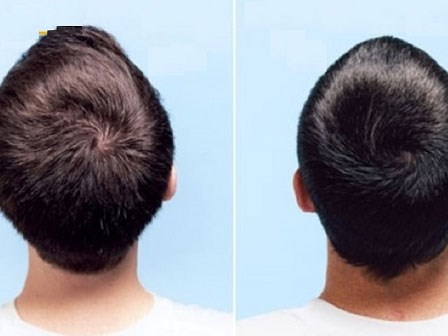 Vạch tóc xem xoáy trên đầu để hiểu thêm về mình