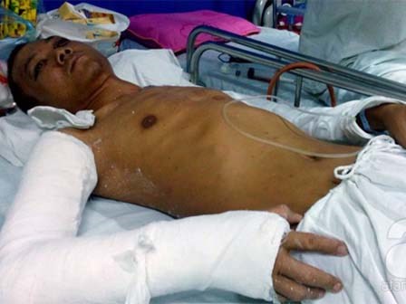 Đang ngồi uống nước ở vỉa hè bị 10 côn đồ truy sát đến trọng thương