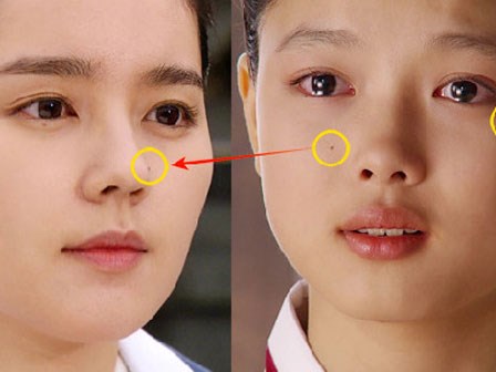 Vị trí nốt ruồi trên mặt cho biết vận mệnh cát hung