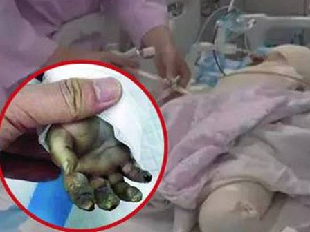 Lạm dụng máy sấy tóc làm đồ chơi, bà mẹ gây đại họa cho con