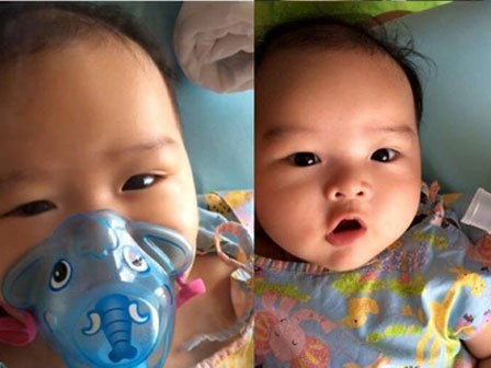 Con trai 5 tháng tuổi suýt chết vì một nụ hôn và lời cảnh báo của bà mẹ dược sĩ