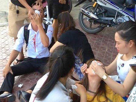 Xử phạt con trai Phó Chủ tịch huyện đánh người yêu cũ nhập viện