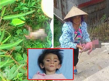 Xót thương phận đời của những đứa trẻ sinh ra đã không may mắn
