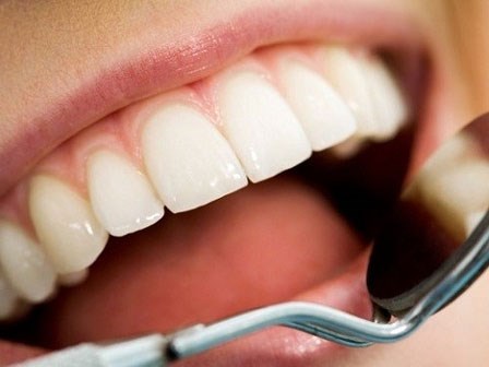 Thực hư việc lấy cao răng làm răng yếu đi