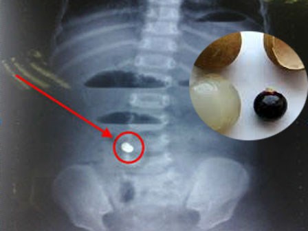 Lơ là, thiếu hiểu biết mẹ để con 