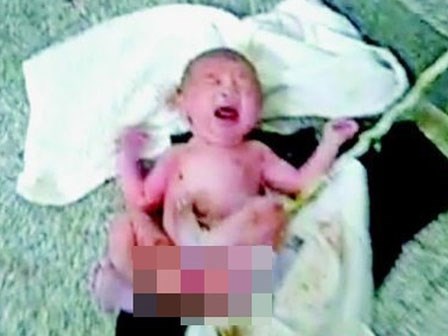 Bé gái còn nguyên dây rốn, dính đầy phân và nước tiểu bị mẹ vứt bỏ trong bồn cầu