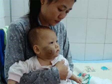 Gặp lại bé Như Ý - nạn nhân bị cha mẹ bạo hành từng gây phẫn nộ tại Đồng Tháp