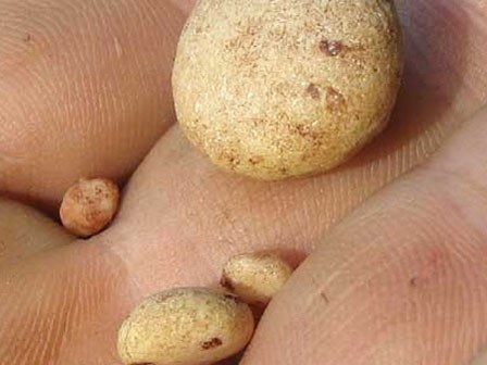 Bài thuốc chữa sỏi thận