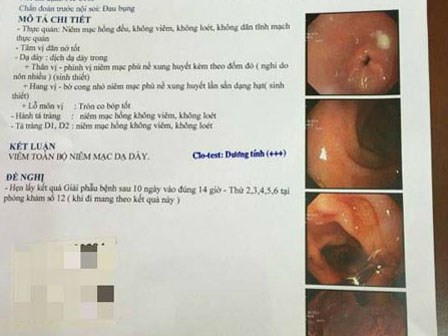 Bé gái 8 tuổi bị viêm toàn bộ niêm mạc dạ dày vì sai lầm mà hầu như mẹ nào cũng mắc