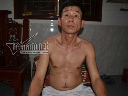 Bệnh nhân