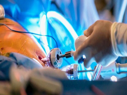 Phụ nữ đã quan hệ tình dục trên 3 năm phải đề phòng bệnh này