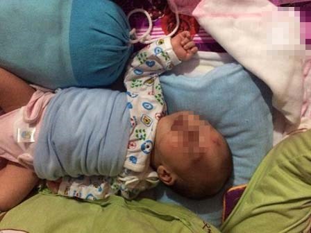 Người mẹ trẻ đau đớn tố bệnh viện tắc trách khiến mẹ đẻ ngạt, con trai bị bại não suốt đời