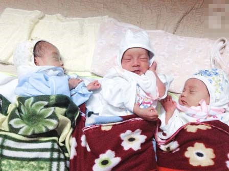 Những hình ảnh mới nhất về 3 em bé của ca sinh nở còn nguyên trong bọc ối