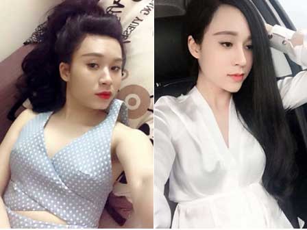 Cô gái nghiện phẫu thuật thẩm mỹ chia sẻ những biến chứng và tác hại mà mình phải chịu đựng