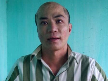 Hận tình, đổ cả can axit lên đầu người yêu