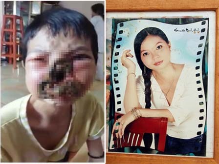 Khủng khiếp những căn bệnh lạ bất ngờ đến khiến người mắc sống khổ hơn chết