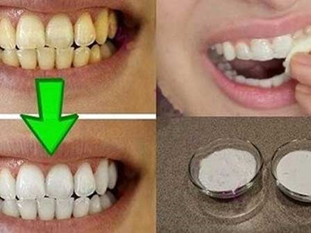 1 nhúm muối và 2 cách làm răng trắng bóng không ê buốt