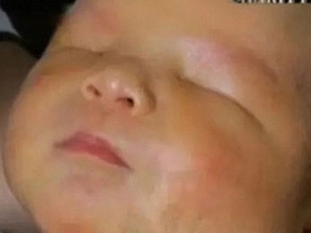 Siêu âm thai bình thường, mẹ ‘chết lặng’ khi đẻ con không có mắt