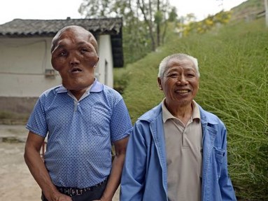 Kỳ dị ông lão có khuôn mặt của “người ngoài hành tinh”