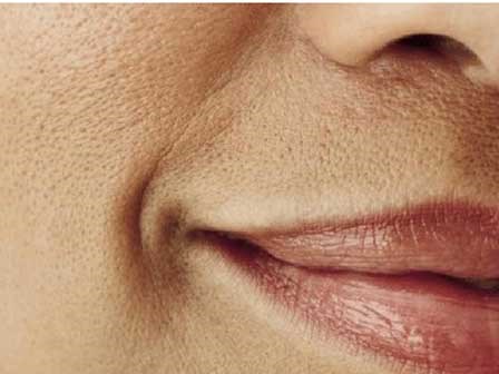 5 thói quen vô tình khiến lỗ chân lông ngày càng to ra