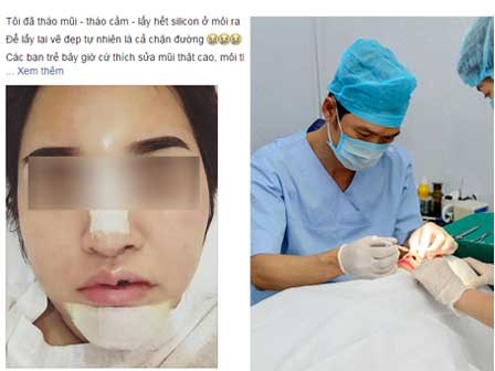 Lời khuyên gửi chị em của cô gái Hà Nội vừa thẩm mỹ xong lại chịu đau để gỡ bỏ hết