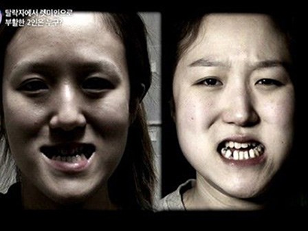 Cặp song sinh hot nhất tuần: Màn lột xác ngoạn mục nhờ phẫu thật thẩm mỹ