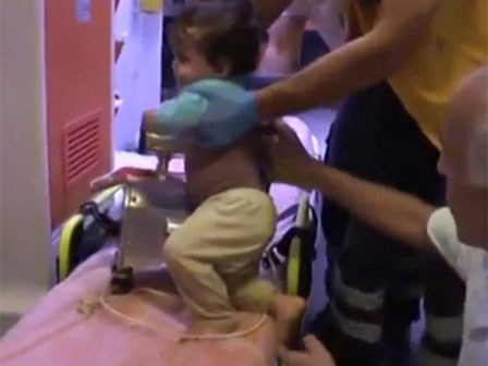 Kẹt tay khi đang nghịch máy xay thịt, bé 1 tuổi suýt bị nát nhừ bàn tay