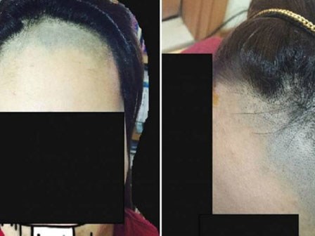1 lít nước mắt: Cô nàng khóc thét bị thợ cắt tóc biến tóc mái thành 