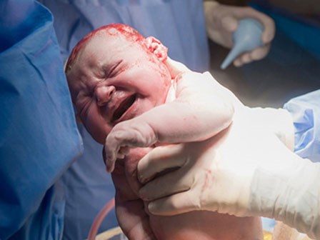 Cận kề cái chết sau ca sinh nở, bà mẹ “lạnh người” khi biết nguyên nhân