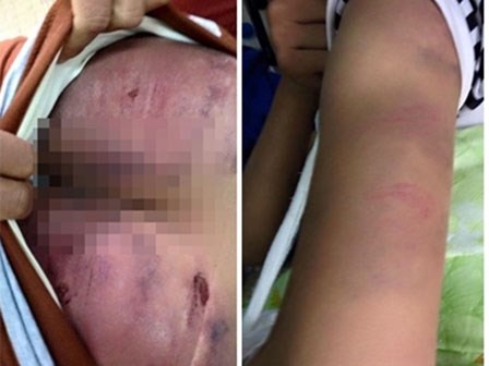 Mẹ giam cầm và đánh đập 2 con đẻ trong nhà suốt 7 năm