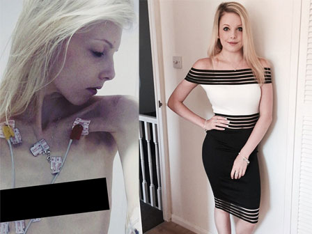 Nghe lời công ty người mẫu mách nhịn ăn để xương gò má lộ ra mới đẹp, cặp song sinh chỉ còn da bọc xương nằm chờ chết và cái kết không ngờ-12