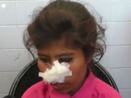 Bạn trai cắn đứt mũi, cô gái trẻ vẫn tha thứ, 1 năm sau bị tên này giết hại nhưng mức án dành cho hắn là không thể tin nổi-7