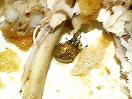 Bà mẹ mang thai 7 tháng nhập viện sau khi ăn gà KFC có chứa nhện