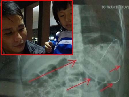 Xót xa người bố 'lực bất tòng tâm' nhìn con gồng mình chống bạo bệnh