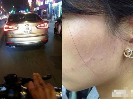 Công an triệu tập tài xế ô tô tát cô gái vì