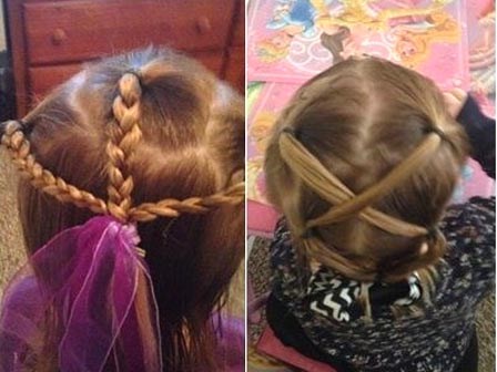 Các mẹ hãy cẩn thận: Cột tóc cho con không an toàn như bạn nghĩ