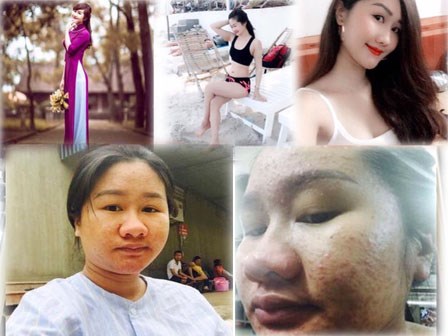 Đắng lòng cô gái trẻ từ xinh lung linh đến