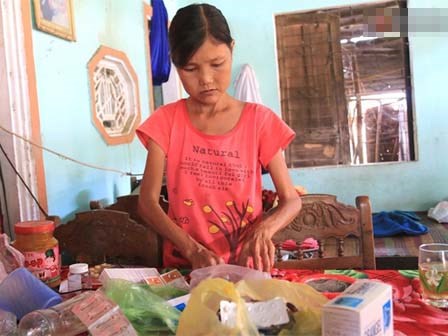 Cô gái mang khuôn mặt bà lão ăn gấp 10 lần người thường, uống mỗi ngày 36 lít nước