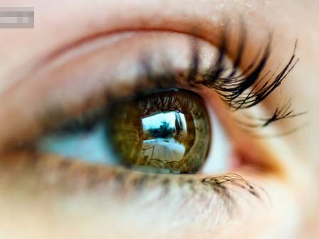 Cảnh báo: Người có dấu hiệu này ở mắt có thể sắp đột quỵ