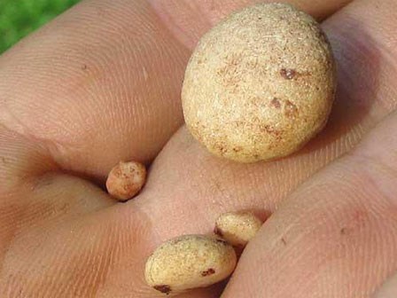 Những thói quen ăn uống dễ gây ra sỏi thận: Người Việt giật mình thon thót!