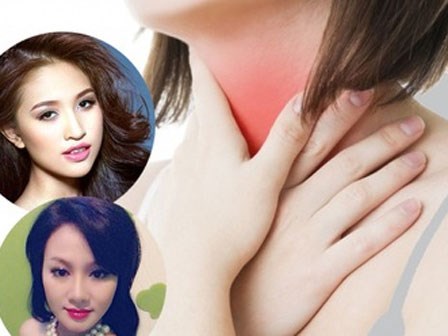 Xơ dây thanh quản - căn bệnh có thể Thanh Vân Hugo và ca sĩ Thu Phượng bị câm nguy hiểm thế nào?