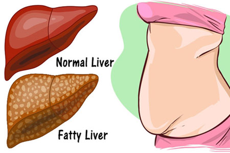 Chuyên gia dinh dưỡng BV Bạch Mai bật mí 2 cách thải độc gan, thận cực kỳ đơn giản-3